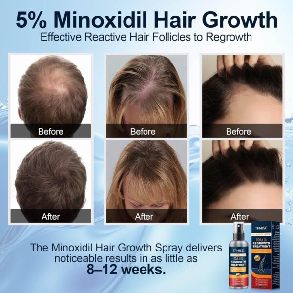 Hair Growth Serum - Image 3